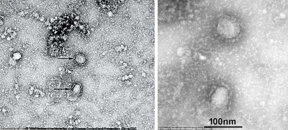 37 после ковида. Коронавирус под микроскопом. Коронавирус микроскопия. Вирус ковид 19 под микроскопом. Коронавирус в микроскопе.